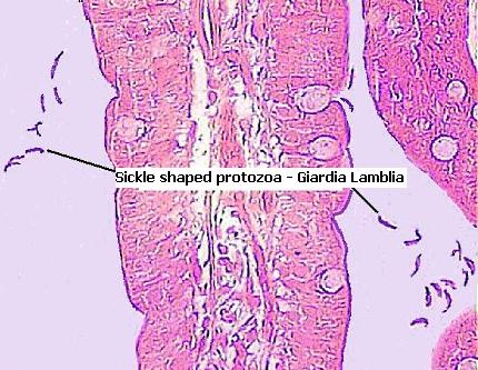 giardia colon histology)