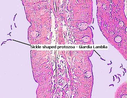 giardia colon histology