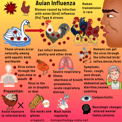 Pathology of Avian Influenza (Bird Flu) - Dr Sampurna Roy MD