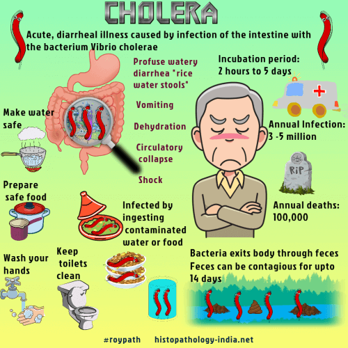 Cholera is caused by