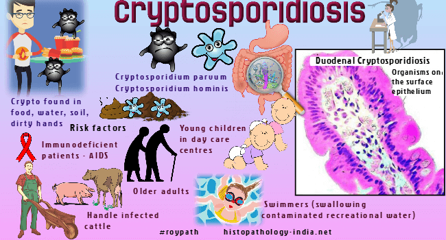 Diferența dintre Cryptosporidium și Giardia