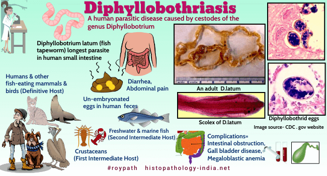 Update on the Human Broad Tapeworm (Genus Diphyllobothrium