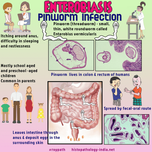 Enterobiosis patogenezis, Enterobiasis (pinworms) gyermekeknél