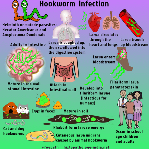 Pathology of Hookworm Infection (Ancylostomiasis) - Dr Sampurna Roy MD