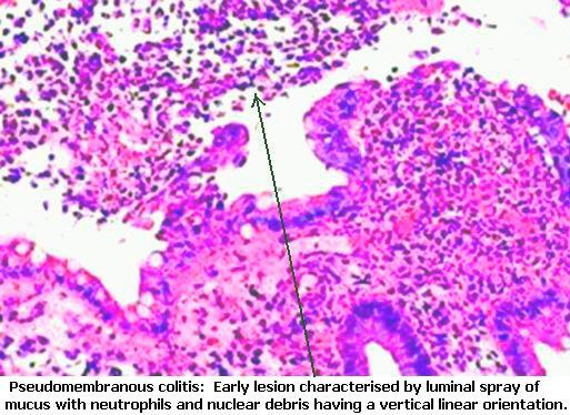 Pathology Of Fever Pdf