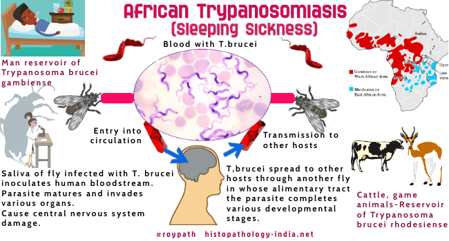Pathology of African Trypanosomiasis or Sleeping Sickness - Dr Sampurna Roy  MD