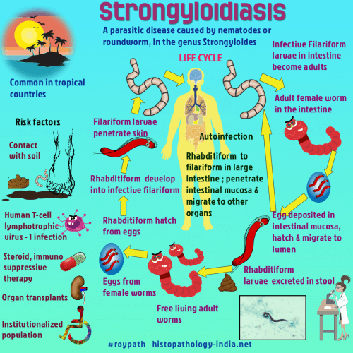 a strongyloidosis