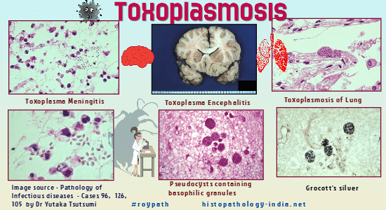 Toxoplasma gondii – Wikipédia
